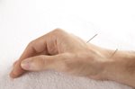 Acupuncture-png.jpg